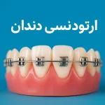 ارتودنسی دندان