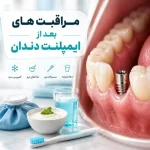 مراقبت های بعد از ایمپلنت دندان