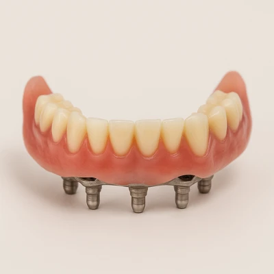 هزینه ایمپلنت دندان با بیمه تامین اجتماعی