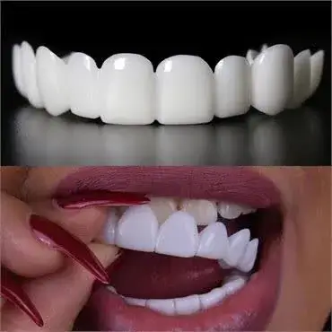 زیبایی لبخند با اسنپ اسمایل - تغییر فوری دندان‌ها