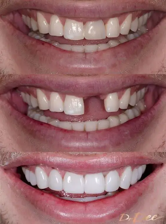 لبخند رؤیایی خود را با Snap Smile بسازید!