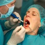 ایمپلنت یک روزه و ایمپلنت فوری