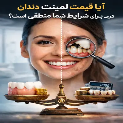 قیمت لمینت دندان در تهران؛ قبل و بعد واقعی لبخند