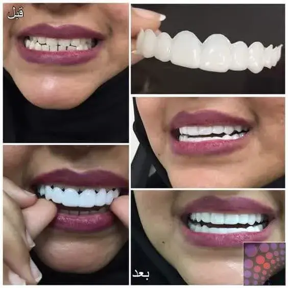 مزایا و معایب لمینت متحرک | بررسی تخصصی