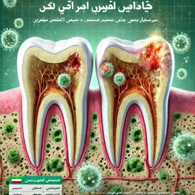 لیست قوی‌ترین قرص‌ها برای عفونت دندان عقل