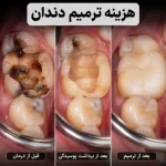 هزینه ترمیم دندان در سال ۱۴۰۵