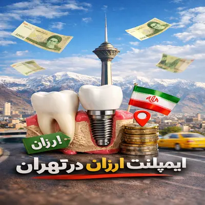 ایمپلنت ارزان تهران