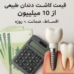قیمت کاشت دندان طبیعی