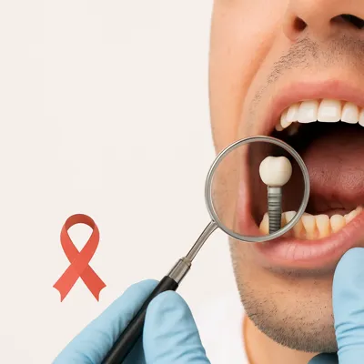 آیا ایمپلنت باعث سرطان میشود؟