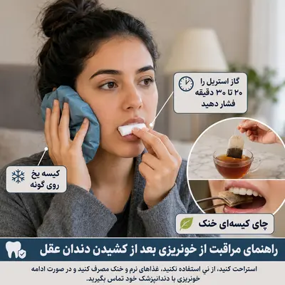 کنترل خونریزی بعد از کشیدن دندان عقل با گاز استریل و کمپرس سرد