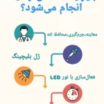 بلیچینگ دندان چگونه انجام می‌شود؟