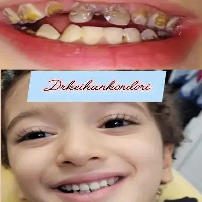 ترس کودک از دندانپزشکی