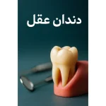 دندان عقل را بکشیم یا نه