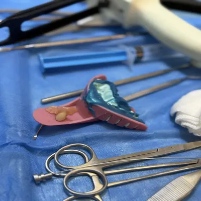 ابزار دندانپزشکی و قالب دندان در حین درمان