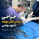 جراحی دندان عقل نهفته با بیهوشی؛ هزینه، ترس و انتخاب روش