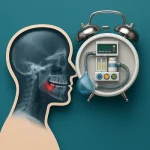 بیهوشی برای جراحی دندان عقل