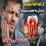 از کجا بفهمیم دندان به عصب رسیده