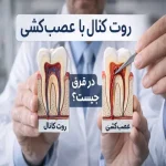 فرق روت کانال با عصب‌کشی