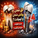 لق شدن روکش دندان و لق شدن روکش ایمپلنت