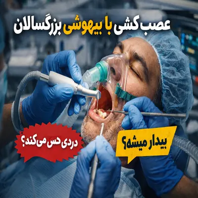 عصب‌کشی با بیهوشی بزرگسالان