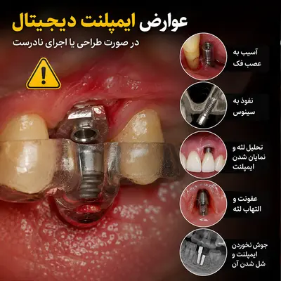 عوارض ایمپلنت دیجیتال