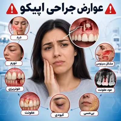 عوارض جراحی اپیکو