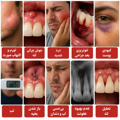 مراقبت‌های بعد از جراحی اپیکو