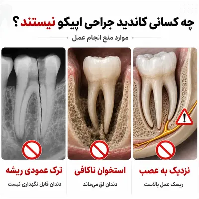 موارد منع جراحی اپیکو دندان
