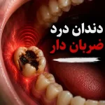 دندان‌درد ضربان‌دار؛ علت نبض دندان و درمان آن